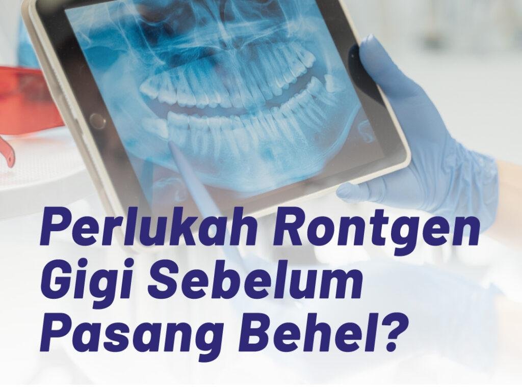 Klinik Gigi dan ortodonti Profesional di Jakarta Timur